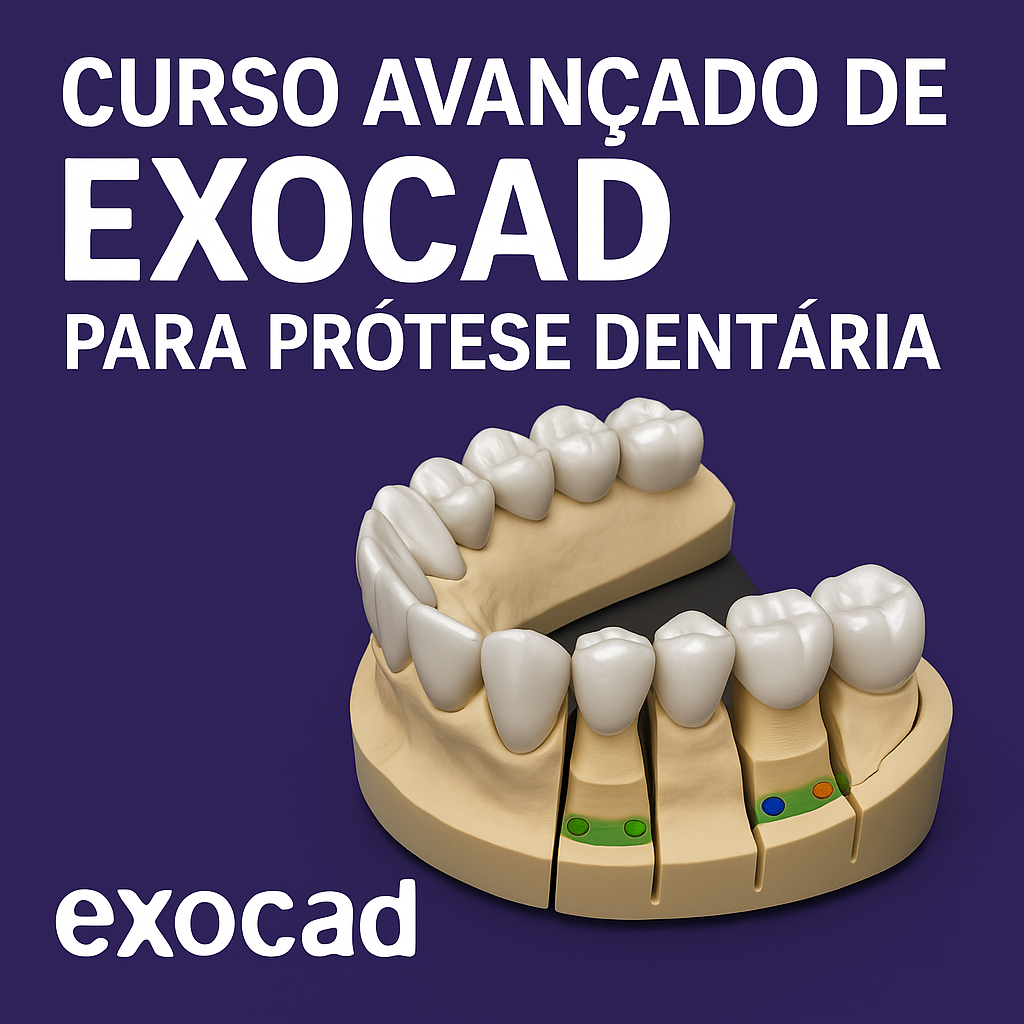 Curso Avançado de Exocad