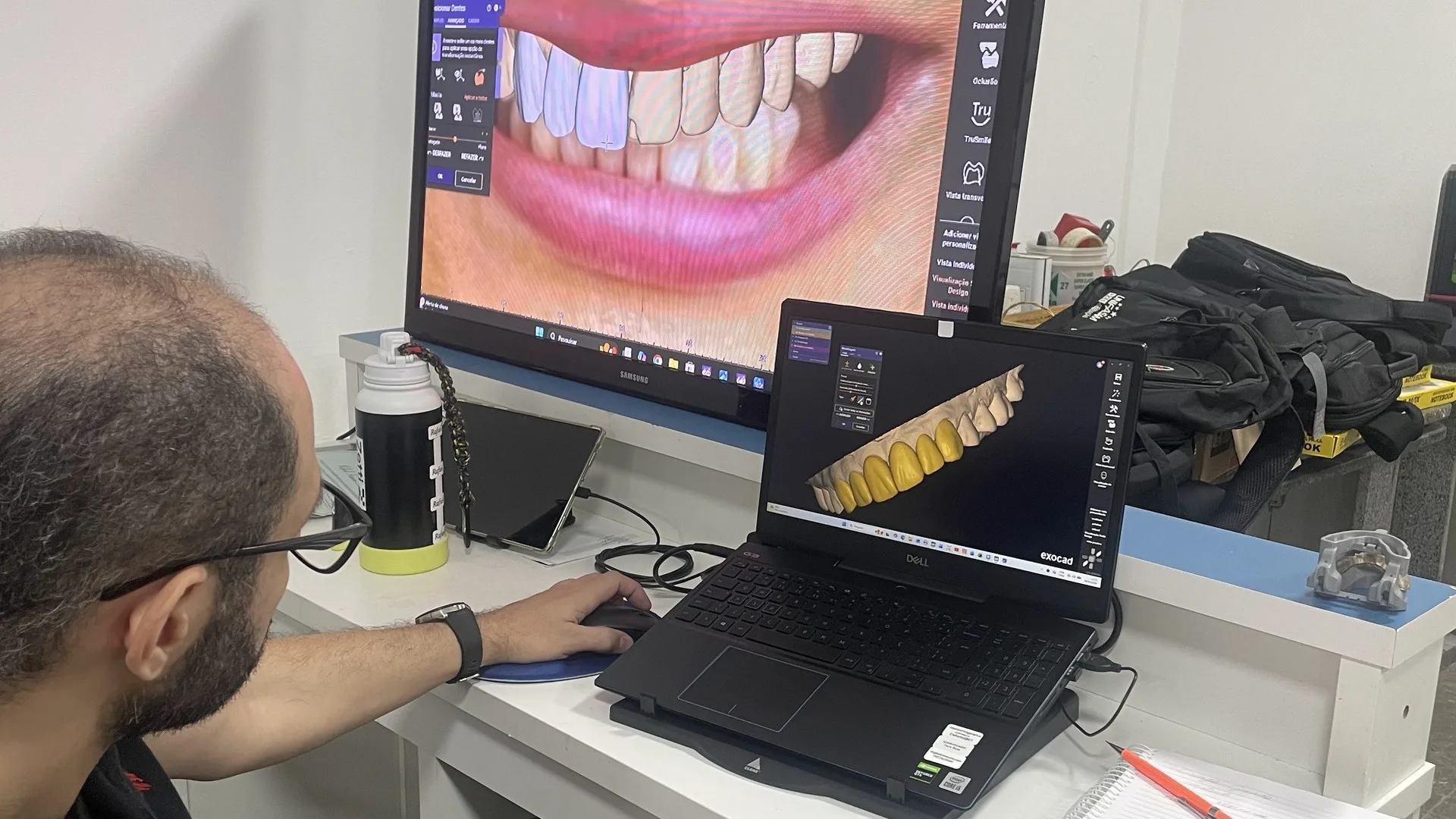 Planejamento CAD em monitor (ExoCAD)