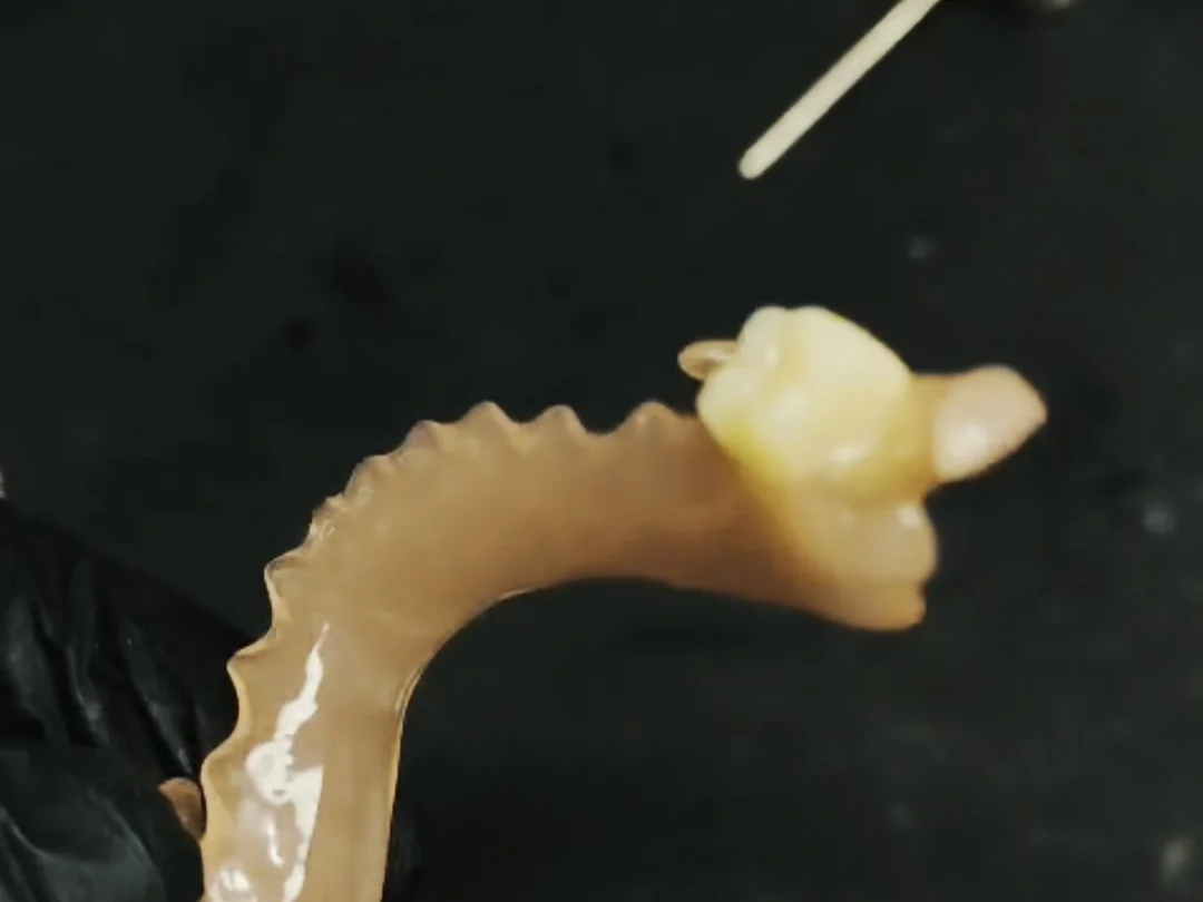 Prótese parcial flexível impressa, sem estrutura metálica, segura pelo técnico no laboratório